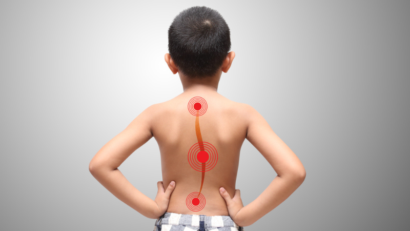 What’s causing your child’s back pain?