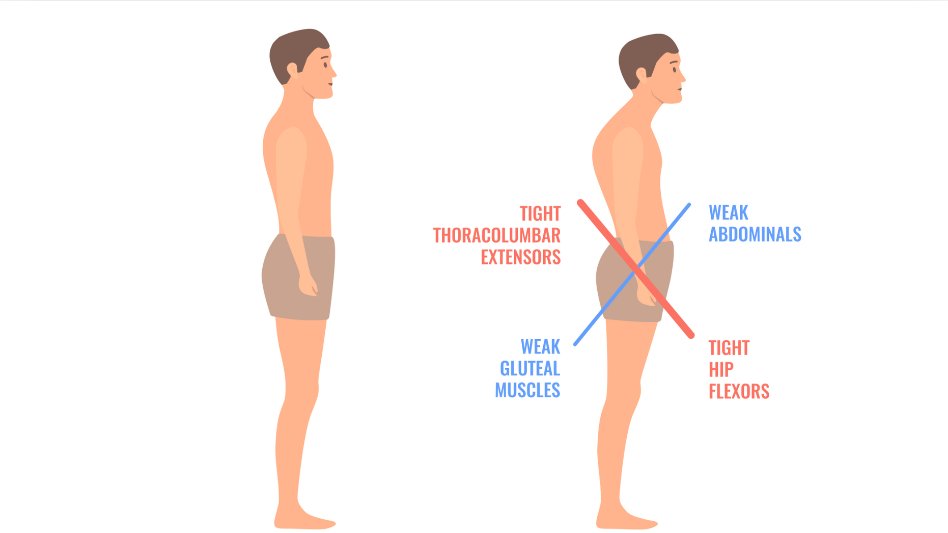 Causes of your child's poor posture