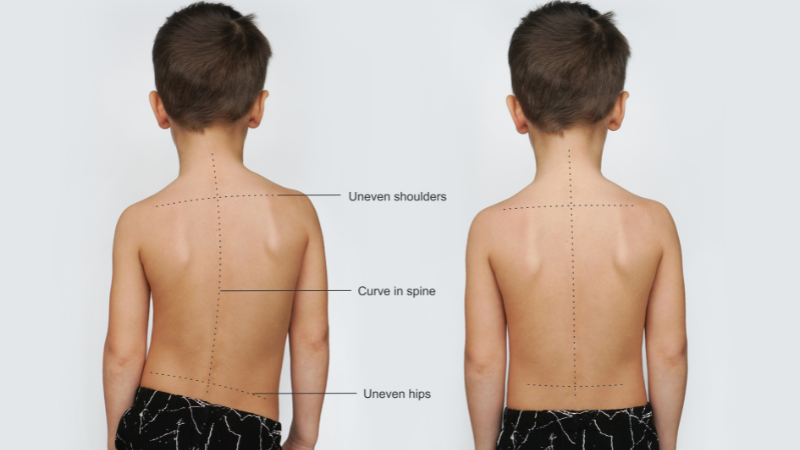 Causing your child’s allergy symptoms